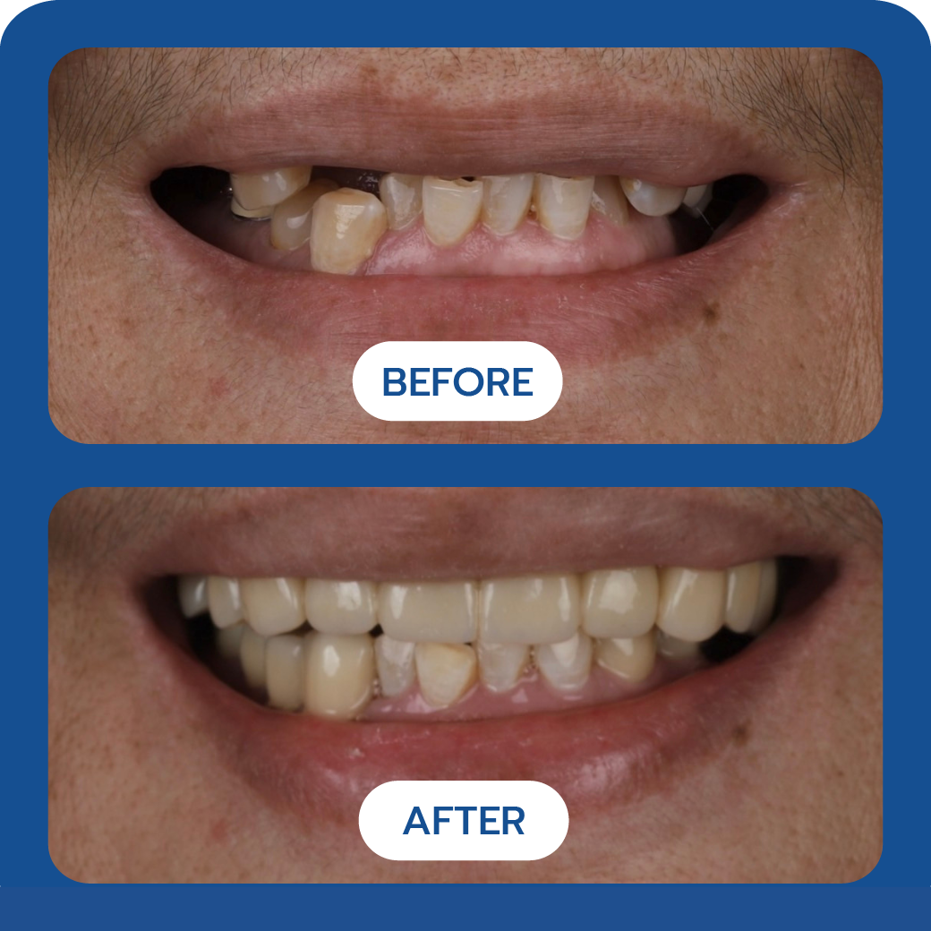 Before and After Case 7